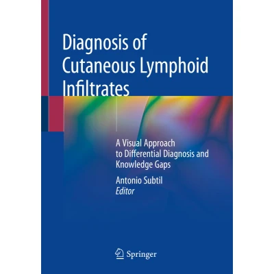 Afbeelding van Diagnosis of Cutaneous Lymphoid Infiltrates: A Visual Approach to Differential and Knowledge Gaps