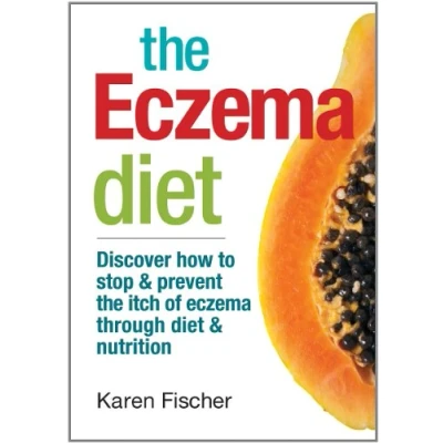 Afbeelding van the Eczema Diet: Discover How to Stop and Prevent Itch of Through Diet Nutrition: &amp; Nutrition
