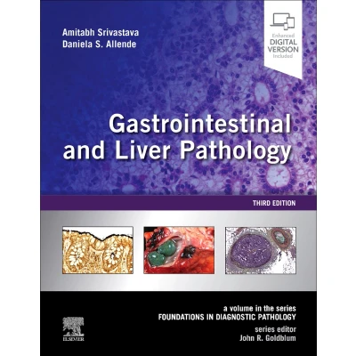 Afbeelding van Gastrointestinal and Liver Pathology: A Volume in the Series: Foundations Diagnostic Pathology