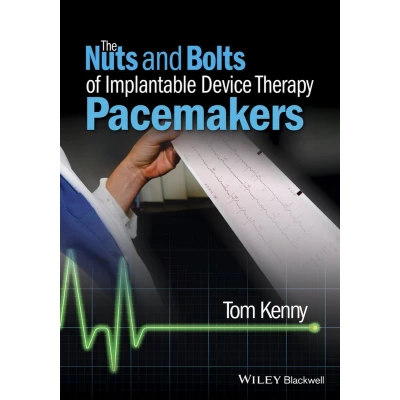 Afbeelding van The Nuts and Bolts of Implantable Device Therapy