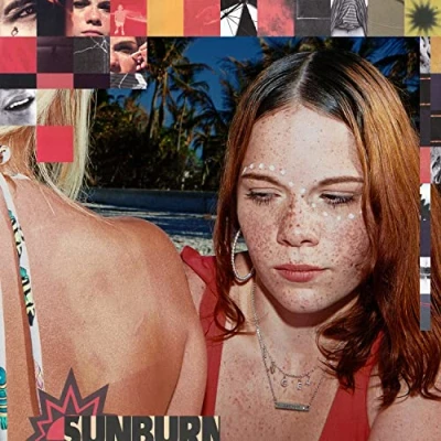 Afbeelding van Sunburn