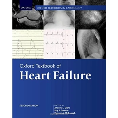 Afbeelding van Oxford Textbook of Heart Failure