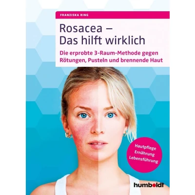 Afbeelding van Rosacea Das hilft wirklich: Die erprobte 3 Raum Methode gegen Rötungen, Pusteln und brennende Haut, Hautpflege, Ernährung, Lebensführung