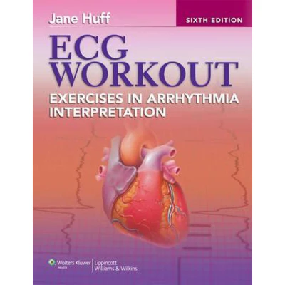 Afbeelding van ECG Workout
