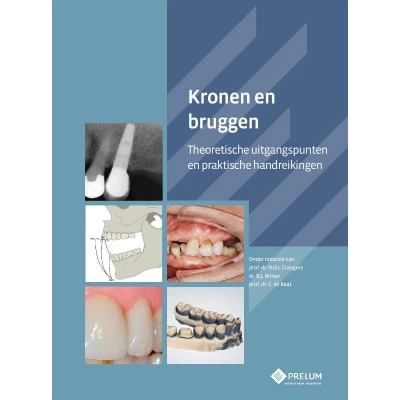 Afbeelding van Kronen en bruggen