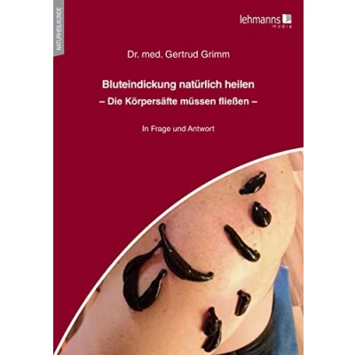 Afbeelding van Bluteindickung natürlich heilen: Die Körpersäfte müssen fließen