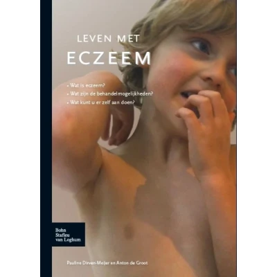 Afbeelding van Leven met eczeem
