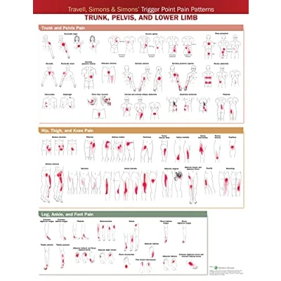 Afbeelding van Travell, Simons &amp; Simons’ Trigger Point Pain Patterns Wall Chart: Trunk, Pelvis, and Lower Limb
