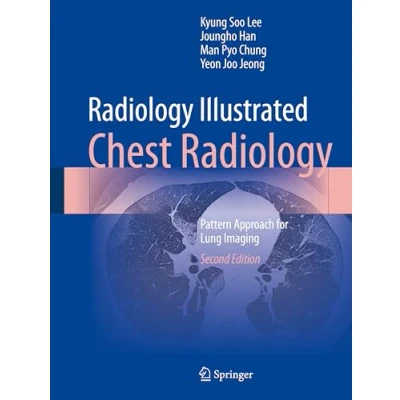 Afbeelding van Radiology Illustrated: Chest Radiology: Pattern Approach for Lung Imaging