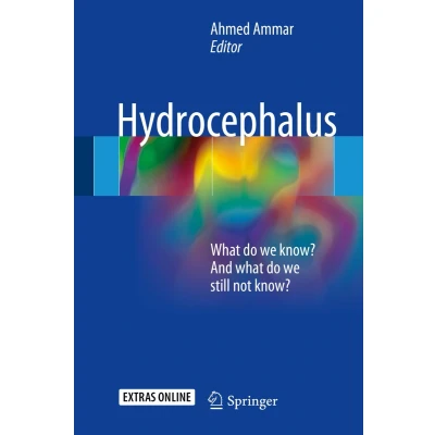 Afbeelding van Hydrocephalus: what do we know? And still not