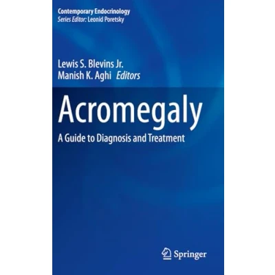 Afbeelding van Acromegaly: A Guide to Diagnosis and Treatment