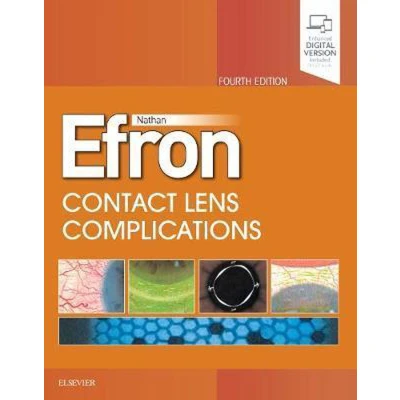 Afbeelding van Contact Lens Complications: Expert Consult Online and Print