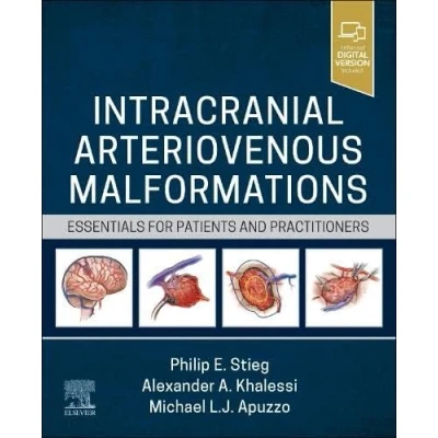 Afbeelding van Intracranial Arteriovenous Malformations: Essentials for Patients and Practitioners