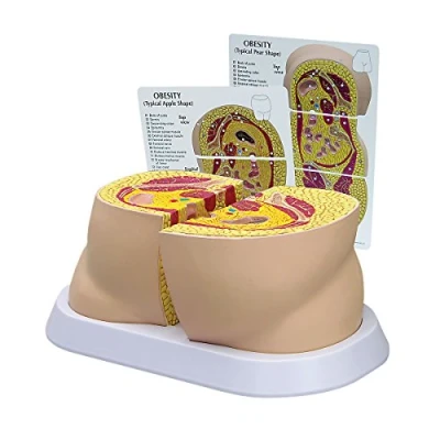 Afbeelding van GPI Anatomicals W33363 Laagheidsmodel