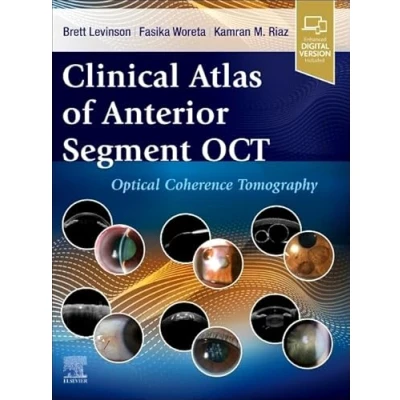 Afbeelding van Clinical Atlas of Anterior Segment OCT: Optical Coherence Tomography