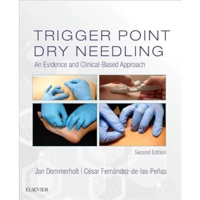 Afbeelding van Trigger Point Dry Needling: An Evidence and Clinical Based Approach