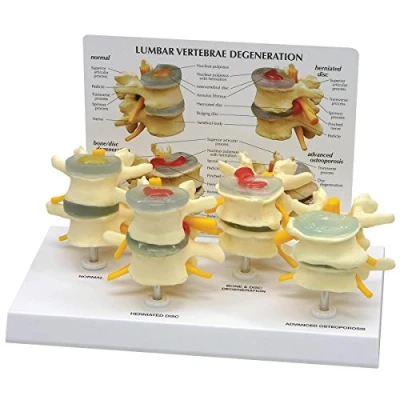 Afbeelding van 3B 4 traps wervelmodelset