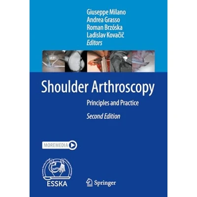 Afbeelding van Shoulder Arthroscopy: Principles and Practice
