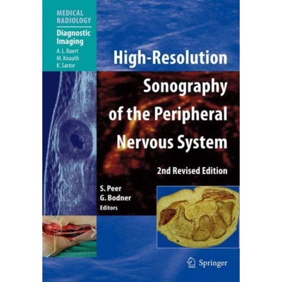 Afbeelding van High Resolution Sonography of the Peripheral Nervous System