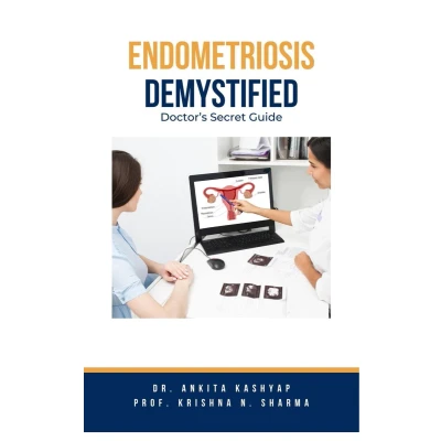 Afbeelding van Endometriosis Demystified: Doctor&#039;s Secret Guide
