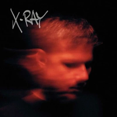 Afbeelding van Murdock X Ray (CD)