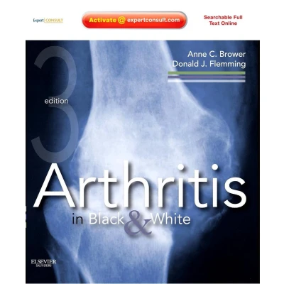 Afbeelding van Arthritis in Black and White: Expert Consult Online Print