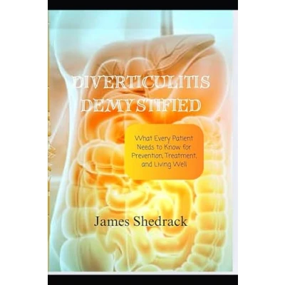 Afbeelding van Diverticulitis Demystified: Doctor&#039;s Secret Guide
