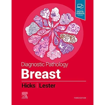 Afbeelding van Diagnostic Pathology: Breast