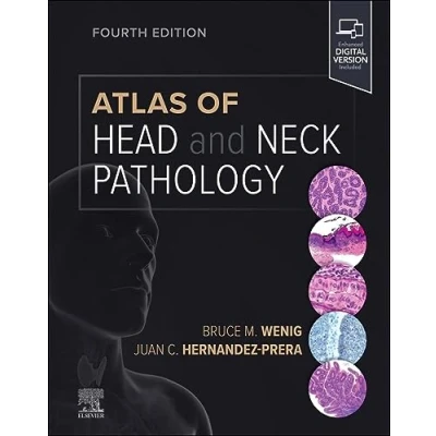 Afbeelding van Atlas of Head and Neck Pathology