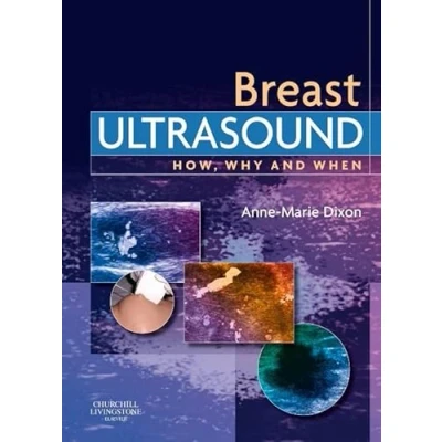 Afbeelding van Breast Ultrasound How Why &amp; When