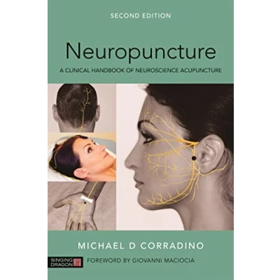 Afbeelding van Neuropuncture: A Clinical Handbook of Neuroscience Acupuncture