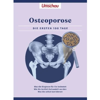 Afbeelding van Apotheken Umschau: Osteoporose: die ersten 100 Tage. Was Diagnose bedeutet Wie Sie ärztlich behandelt werden selbst tun können