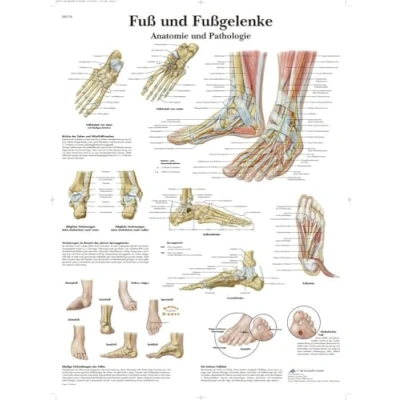 Afbeelding van 3B Scientific Leerbord voet en enkels anatomie pathologie, VR0176UU