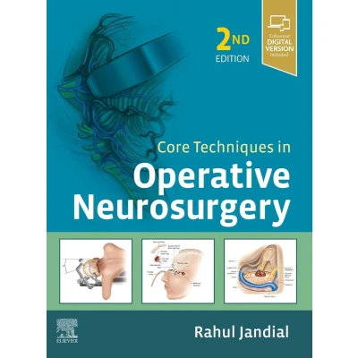 Afbeelding van Core Techniques in Operative Neurosurgery