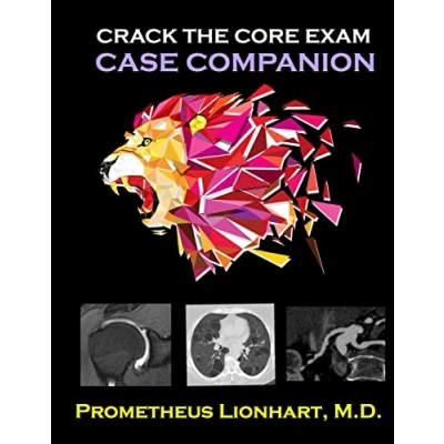 Afbeelding van Crack the CORE Exam Case Companion
