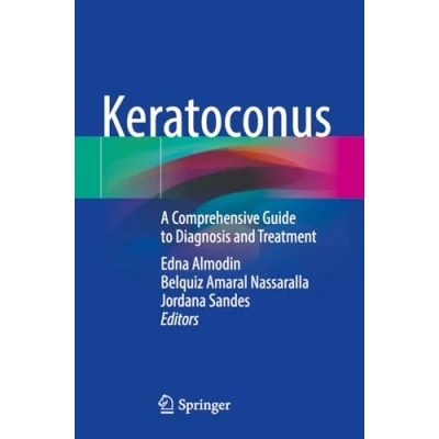 Afbeelding van Keratoconus: A Comprehensive Guide to Diagnosis and Treatment