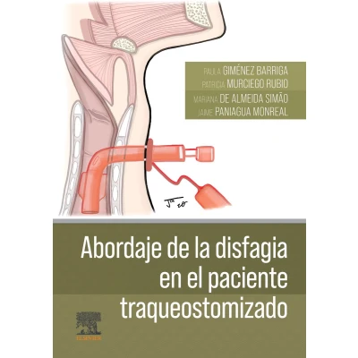 Afbeelding van Abordaje de la disfagia en el paciente traqueostomizado