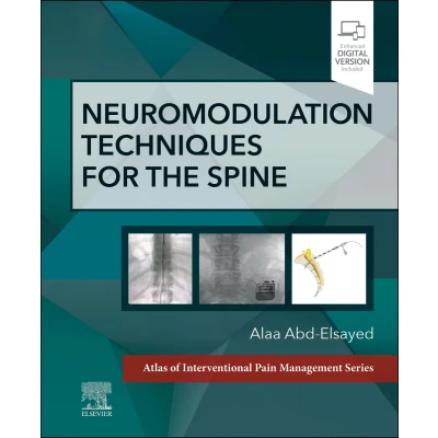 Afbeelding van Neuromodulation Techniques for the Spine: A Volume in Atlas of Interventional Pain Management Series
